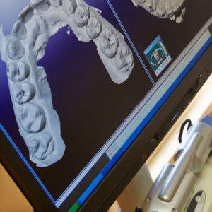 Imersão em Odontologia Digital